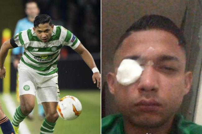 Ex-Celtic star Emilio Izaguirre opens up on horrific derby which left him with glass shards in eye and three fans dead