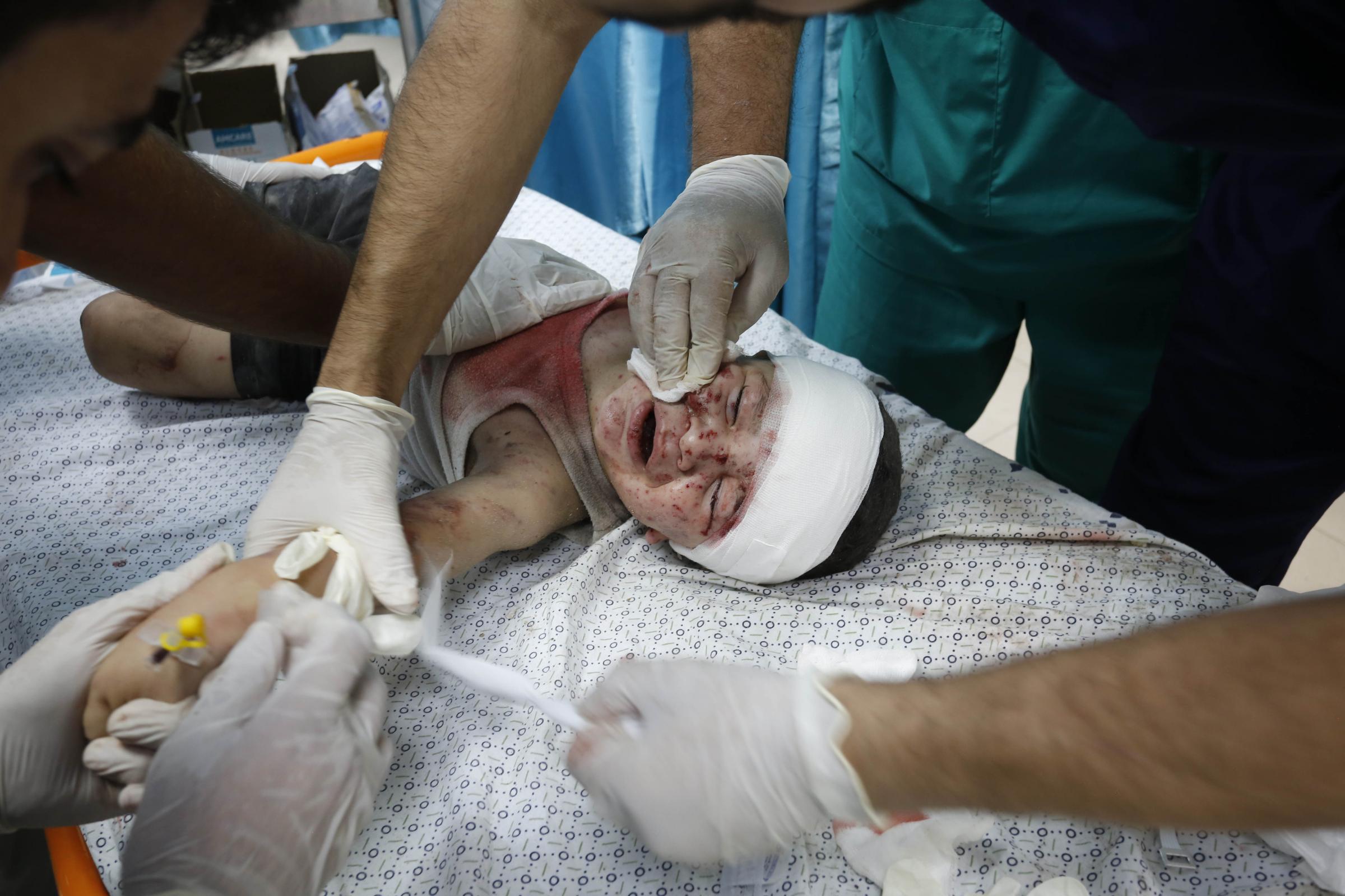 DEIR AL BALAH, GAZA - OCTOBER 14: (EDITORS NOTE: Image depicts graphic content) Doctors examine an injured child at Al-Aqsa Martyr Hospital after being found in search and rescue operations launched around buildings that were destroyed or heavily damaged